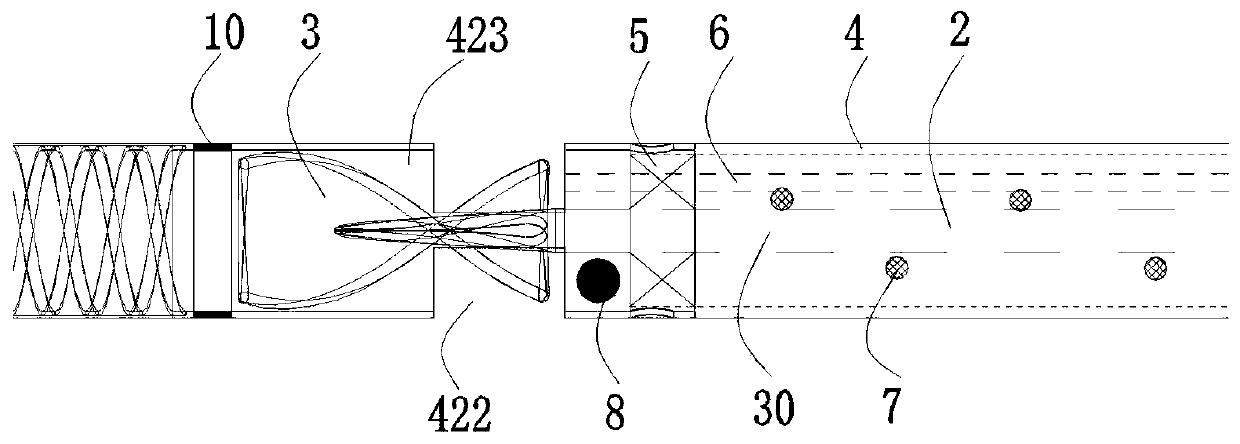 Axial flow ventricular auxiliary device with external drive