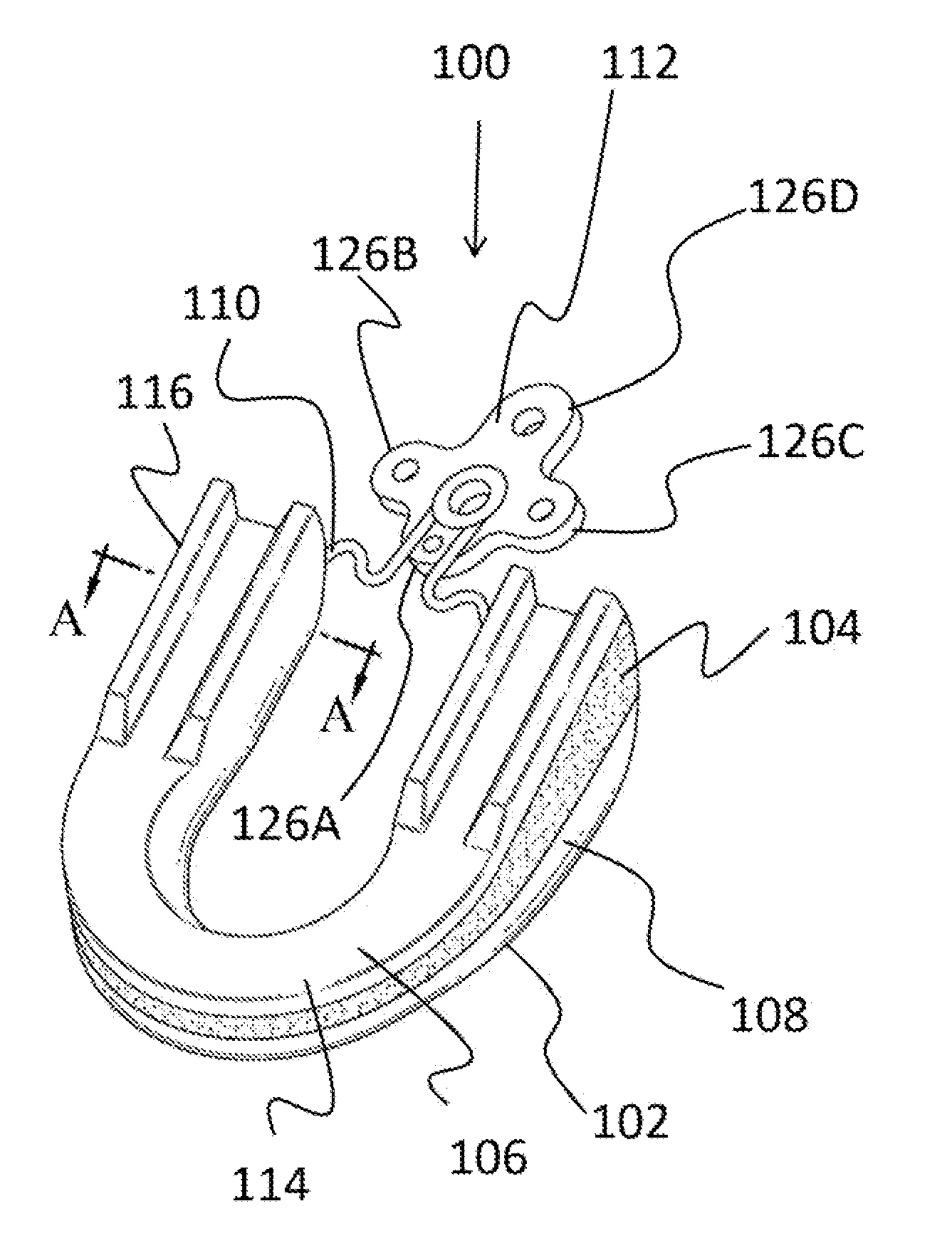 Sleep apnea relief system