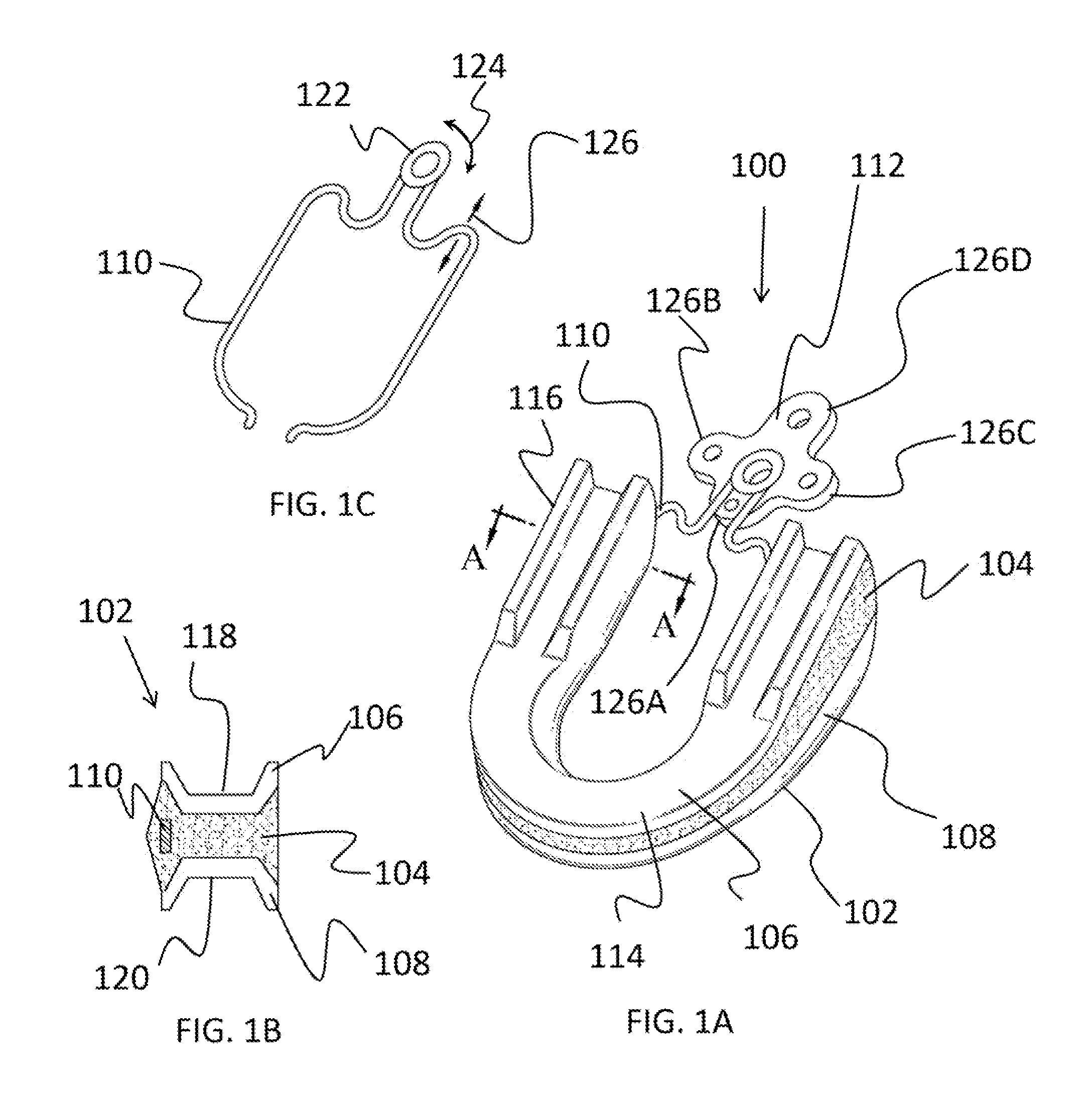 Sleep apnea relief system