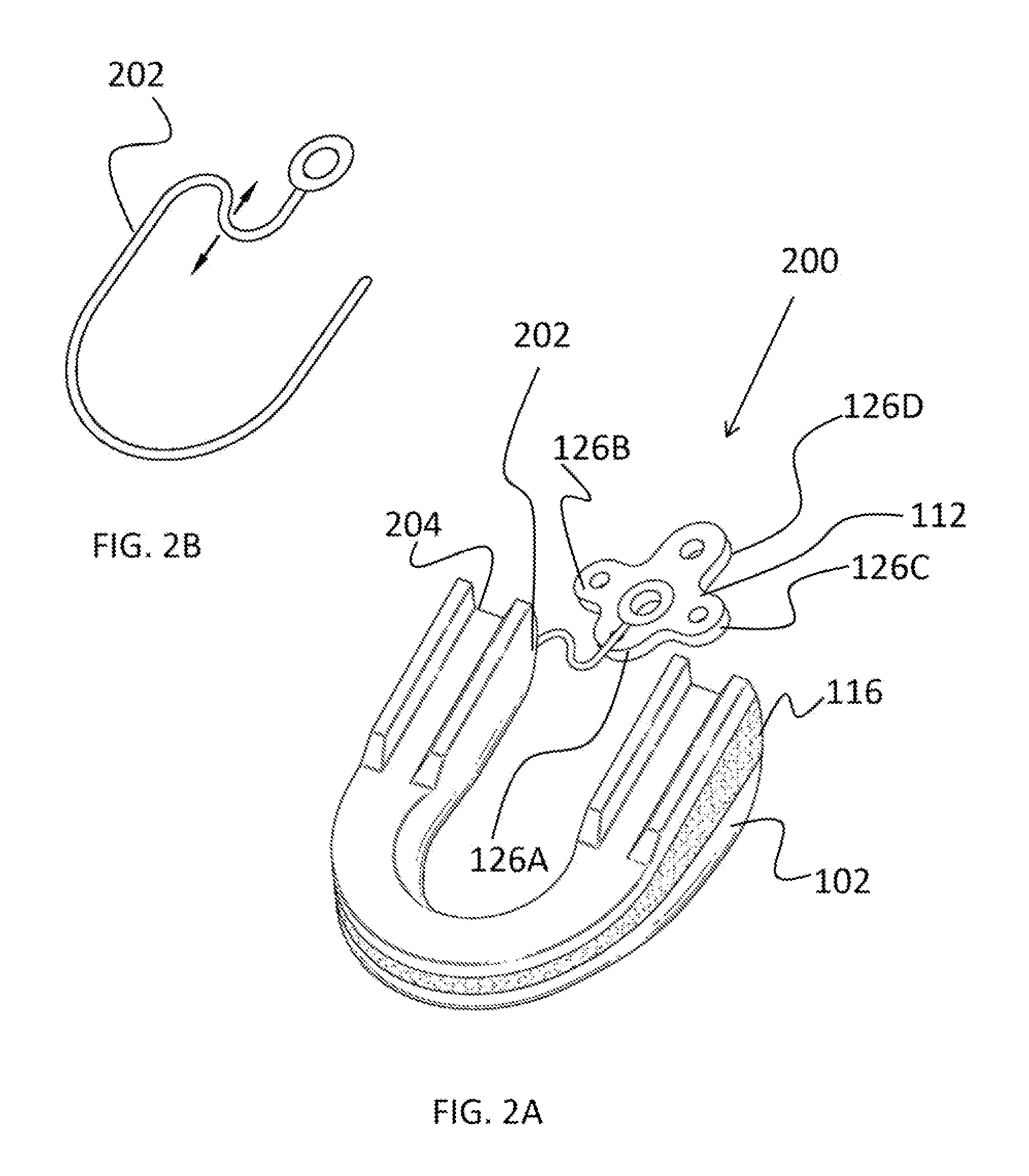 Sleep apnea relief system