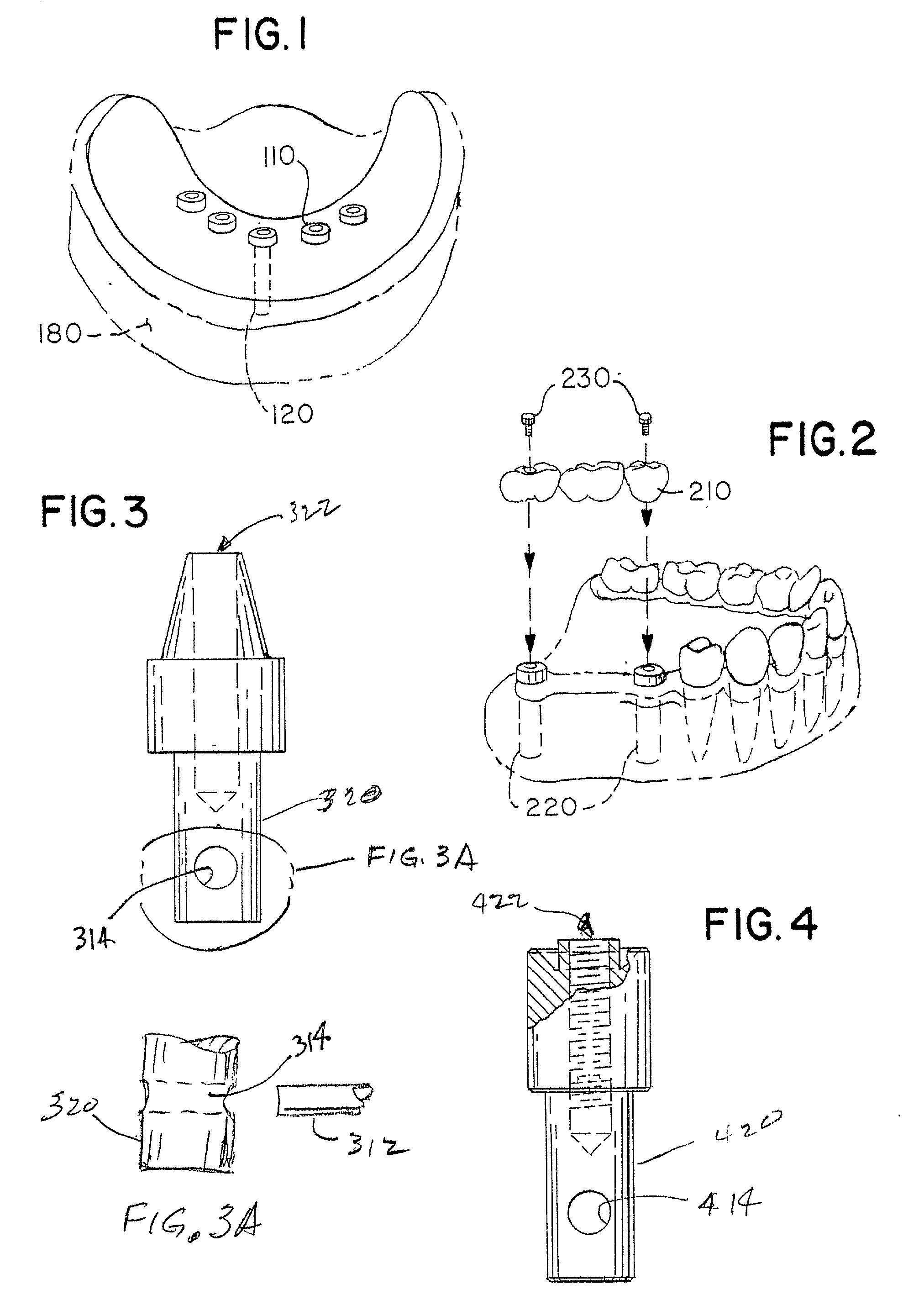 Stable dental analog