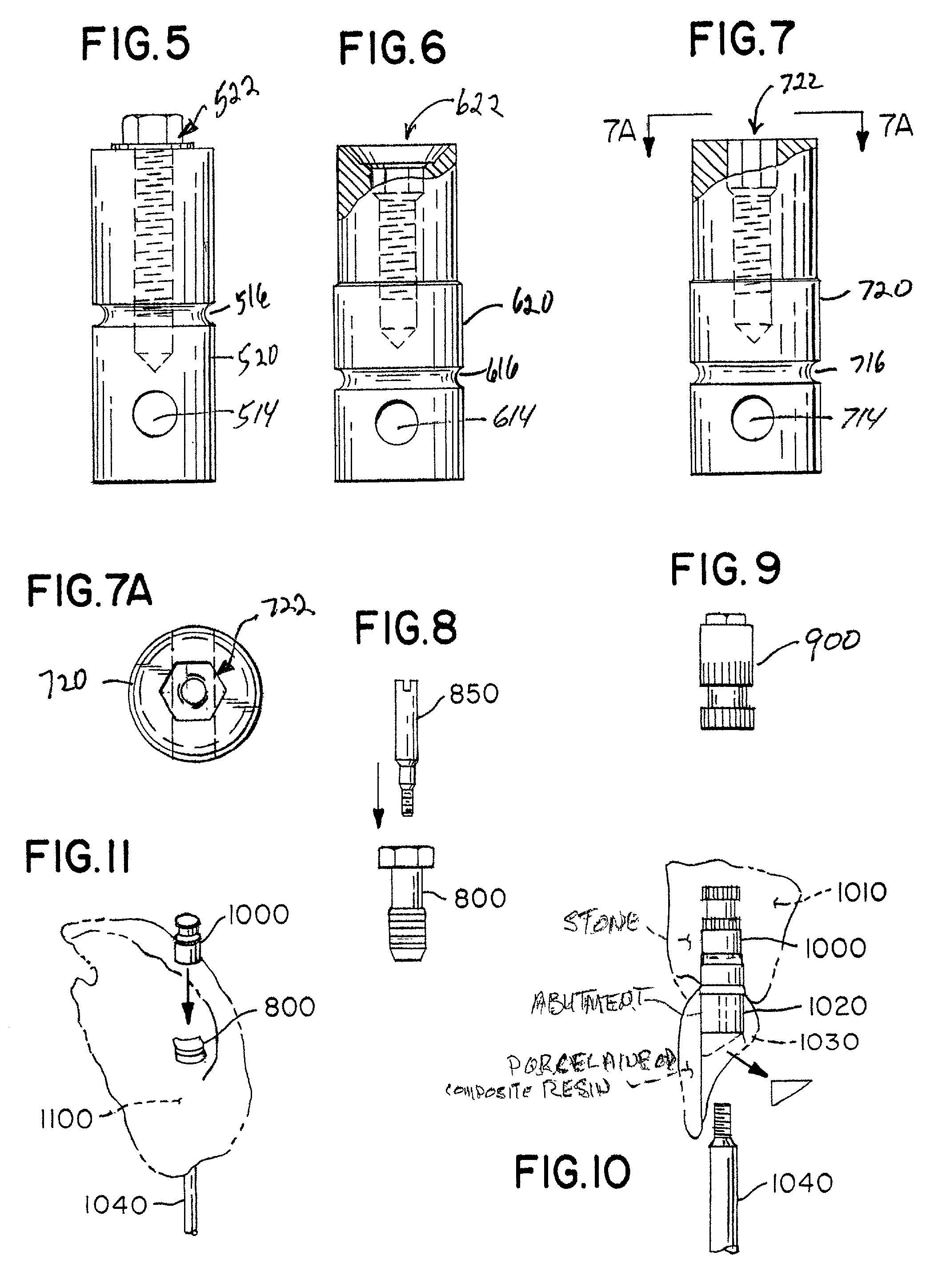 Stable dental analog