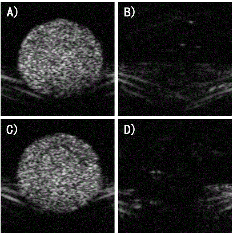 Load small interfering RNA nanoscale lipid microbubble ultrasonic contrast agent and preparation method