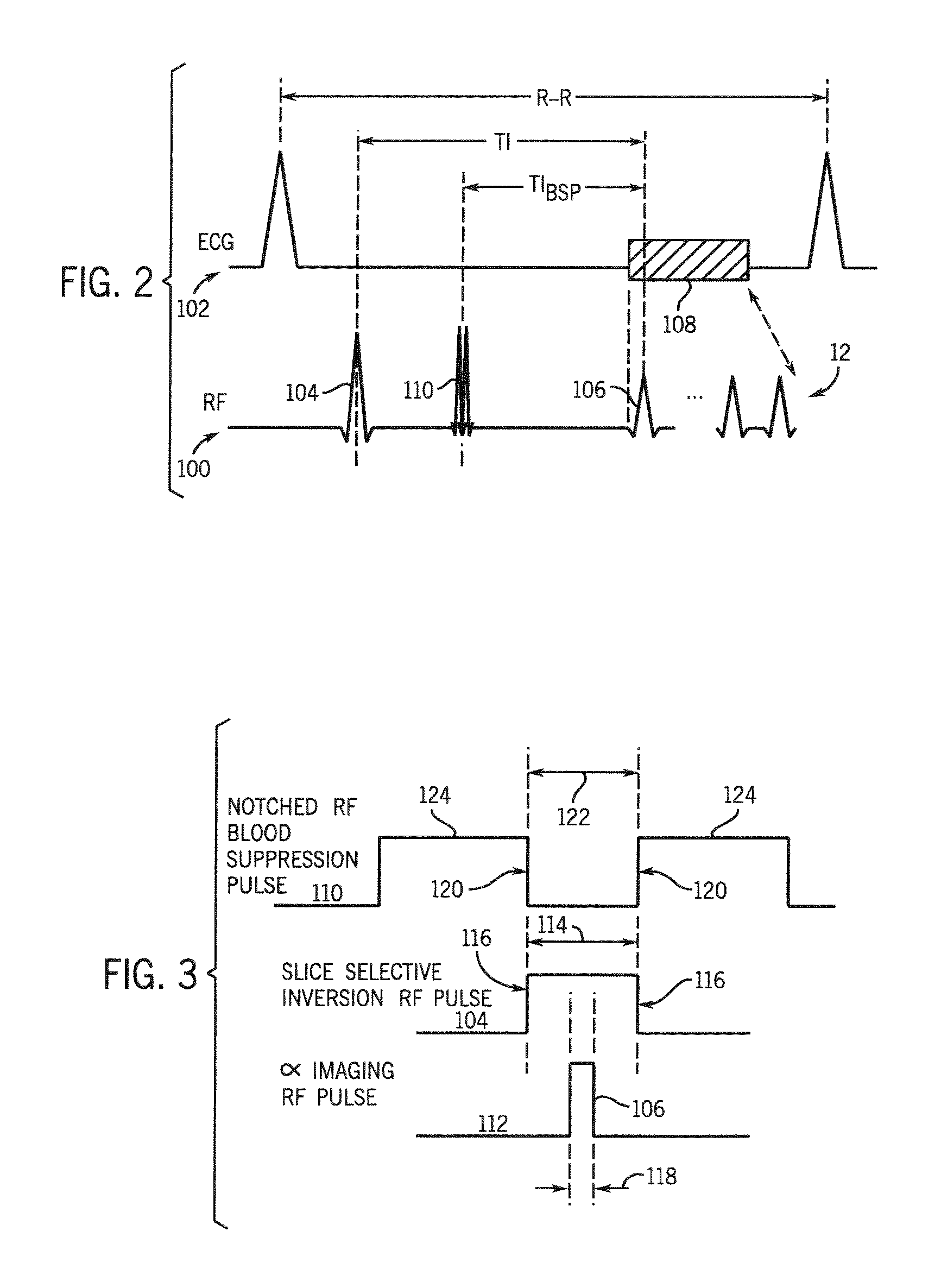 Method and apparatus to improve myocardial infarction detection with blood pool signal suppression