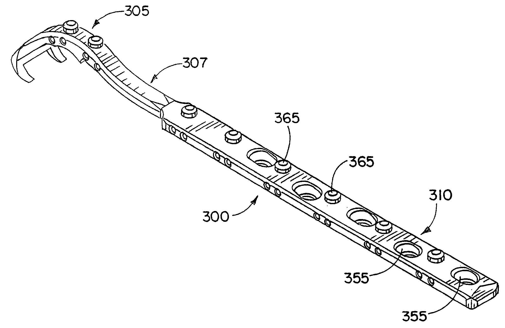 Apparatus and method for repairing the femur