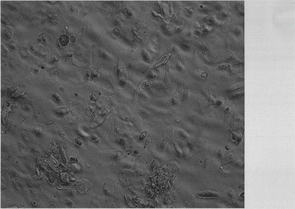 Congenital heart disease ventricular septal defect cell model constructed by transduced SV40LT antigen gene and cell bank thereof