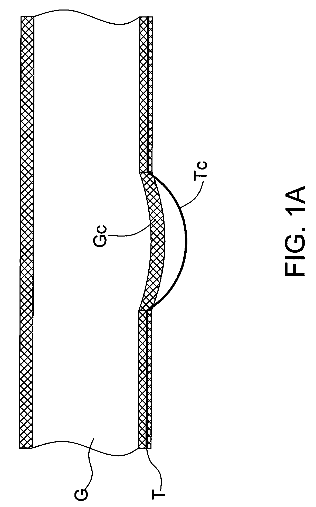 Light guide plate structure