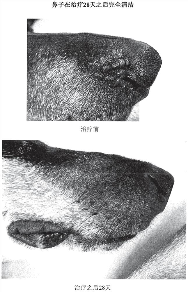 Pemphigus Treatment