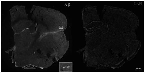 Bifidobacterium lactis Probio-M8 capable of relieving and improving symptoms of Alzheimer's diseases and applications thereof