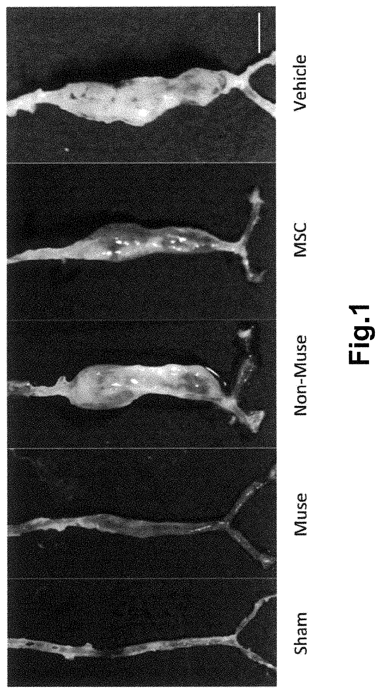 Method of treating aortic aneurysm using muse cells