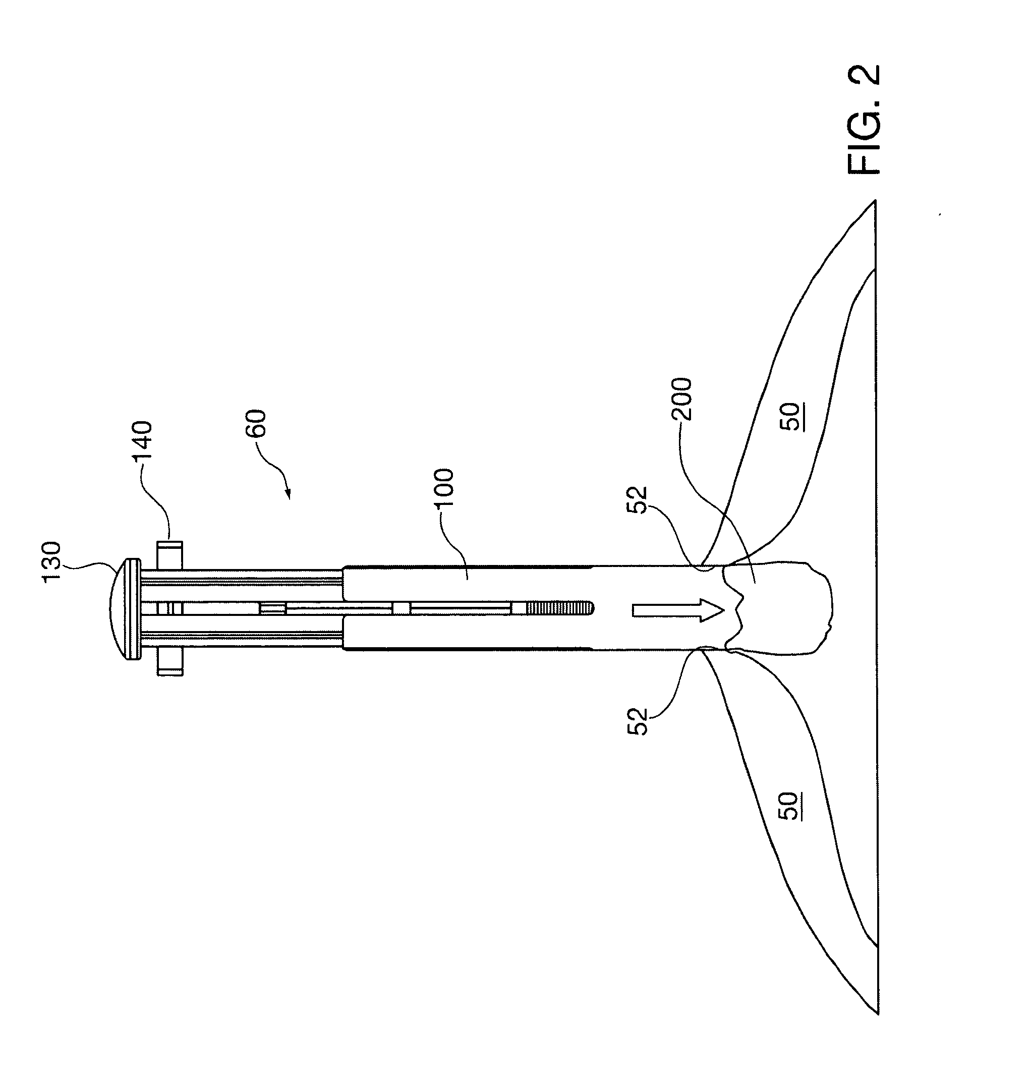 Method and apparatus for minimally invasive delivery, tensioned deployment and fixation of secondary material prosthetic devices in patient body tissue, including hernia repair within the patient's herniation site