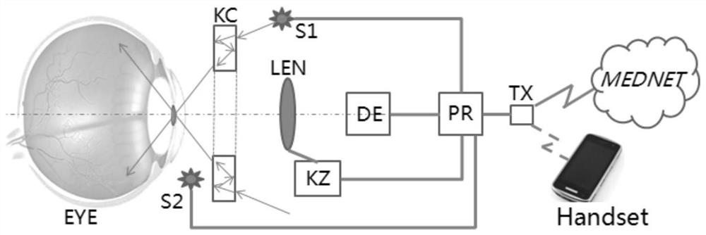 Non-invasive imaging screening and minimally invasive sampling nucleic acid typing combined detection system