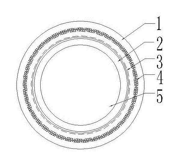 Round window