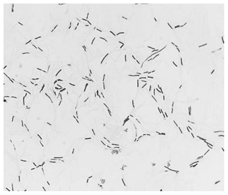 Bacillus coagulans YSF17 and application thereof