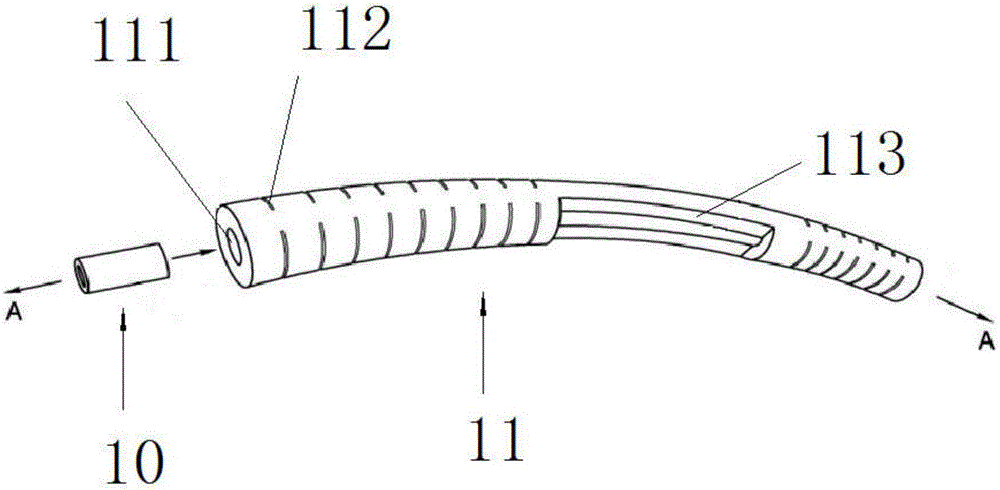 Cervical gear