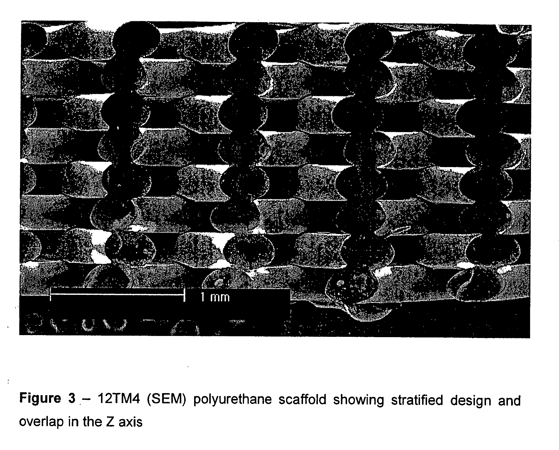 Biodegradable polyurethane and polyurethane ureas