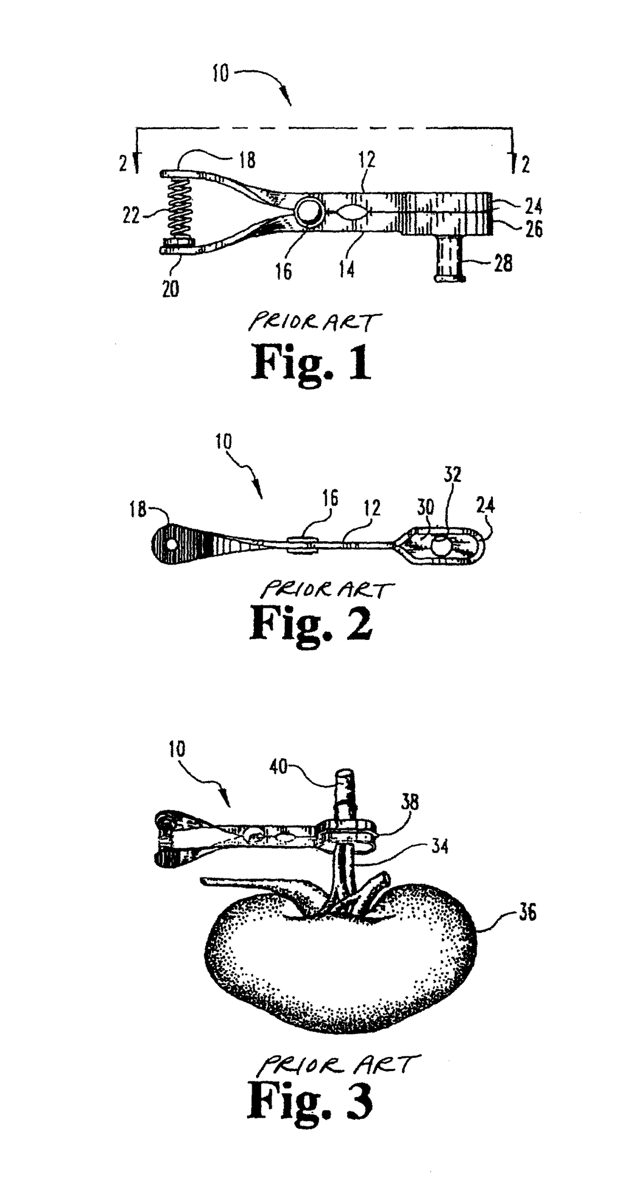 Cannula for a donor organ with or without an aortic cuff or patch