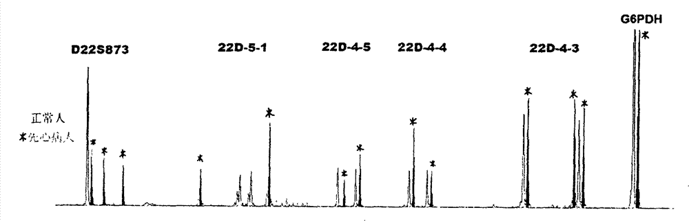 Method for testing chromosome 22q11.2 microdeletion and microduplication