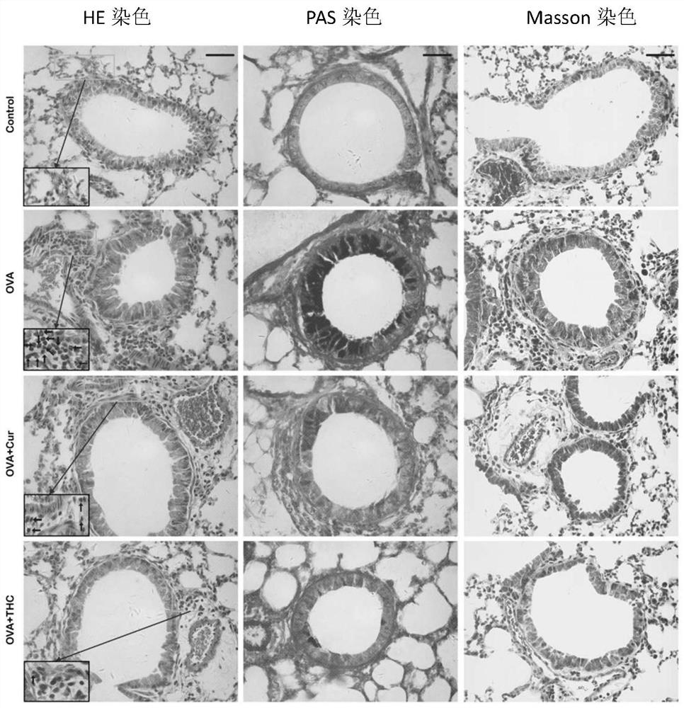 The Application of Tetrahydrocurcumin in Improving Allergic Asthma