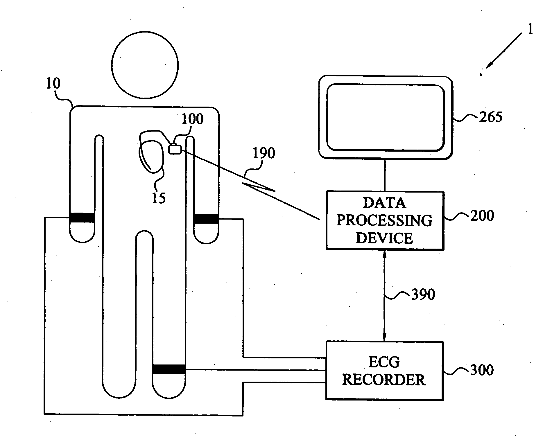 Synchronization of implantable medical devices