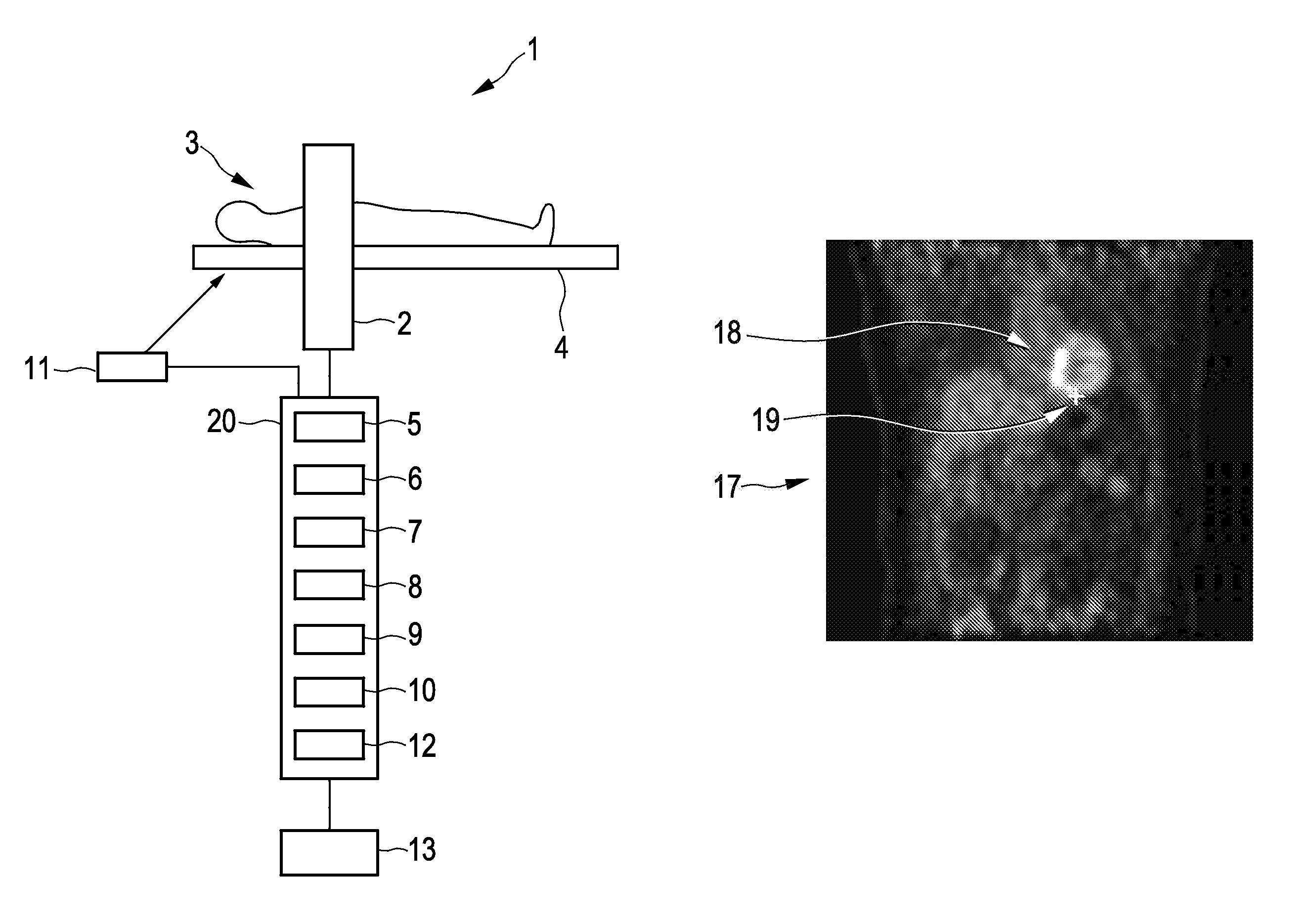 Respiratory motion determination apparatus