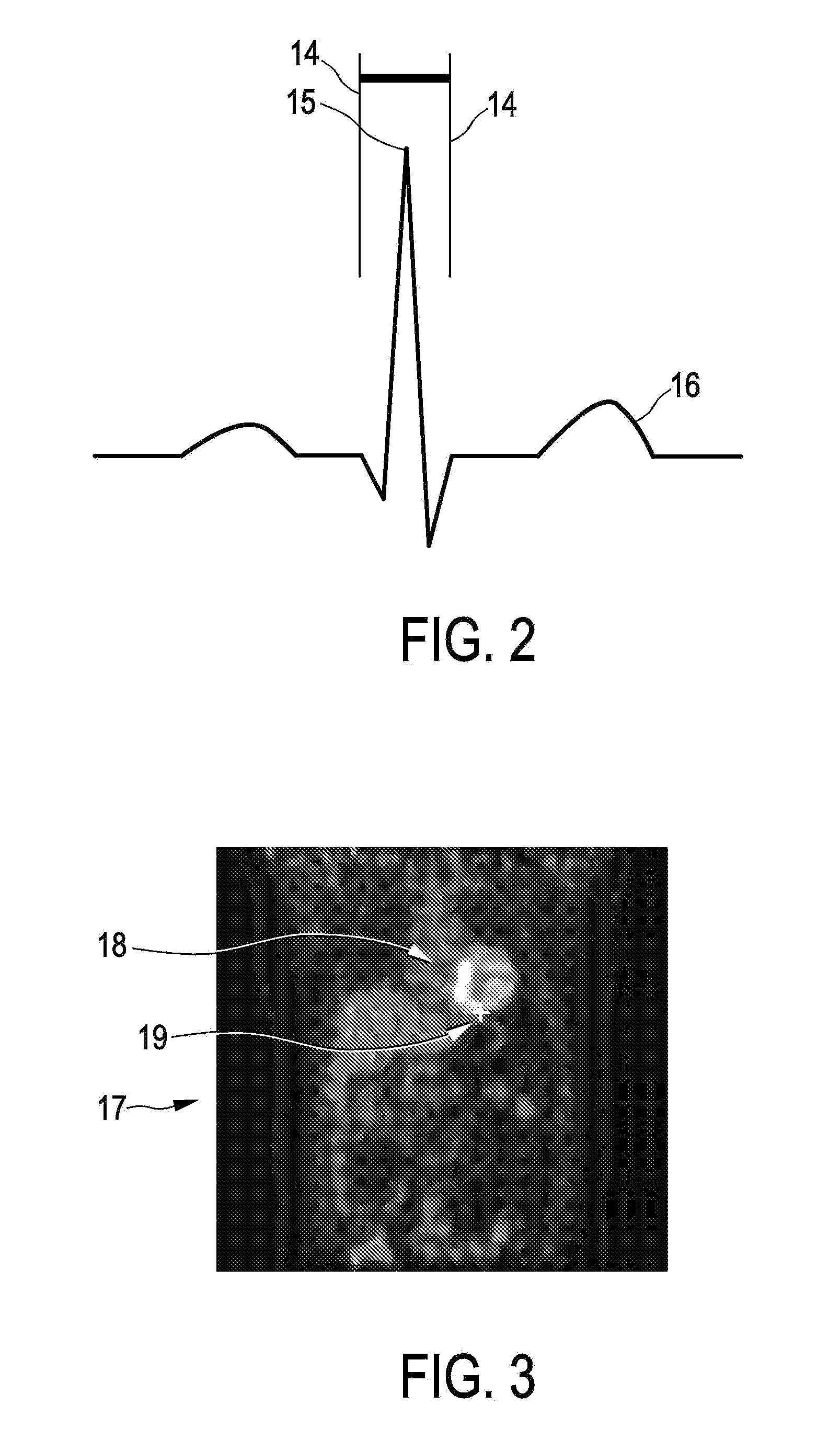 Respiratory motion determination apparatus