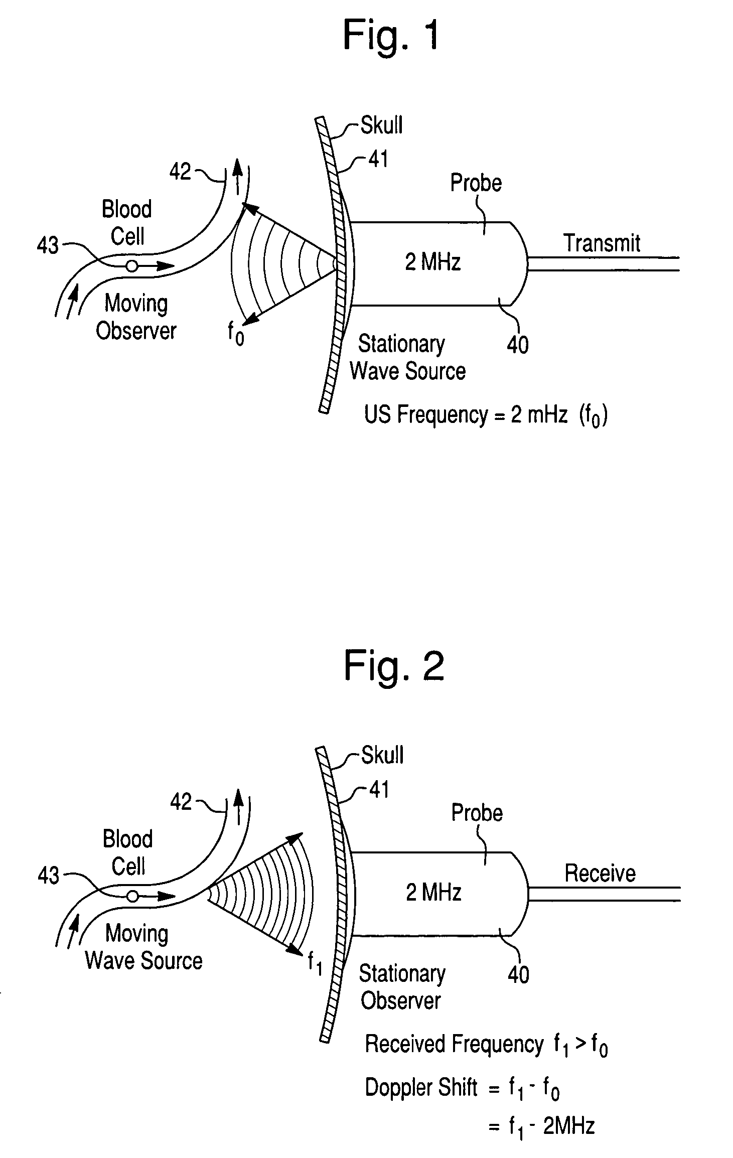 Systems and methods for investigating intracranial pressure