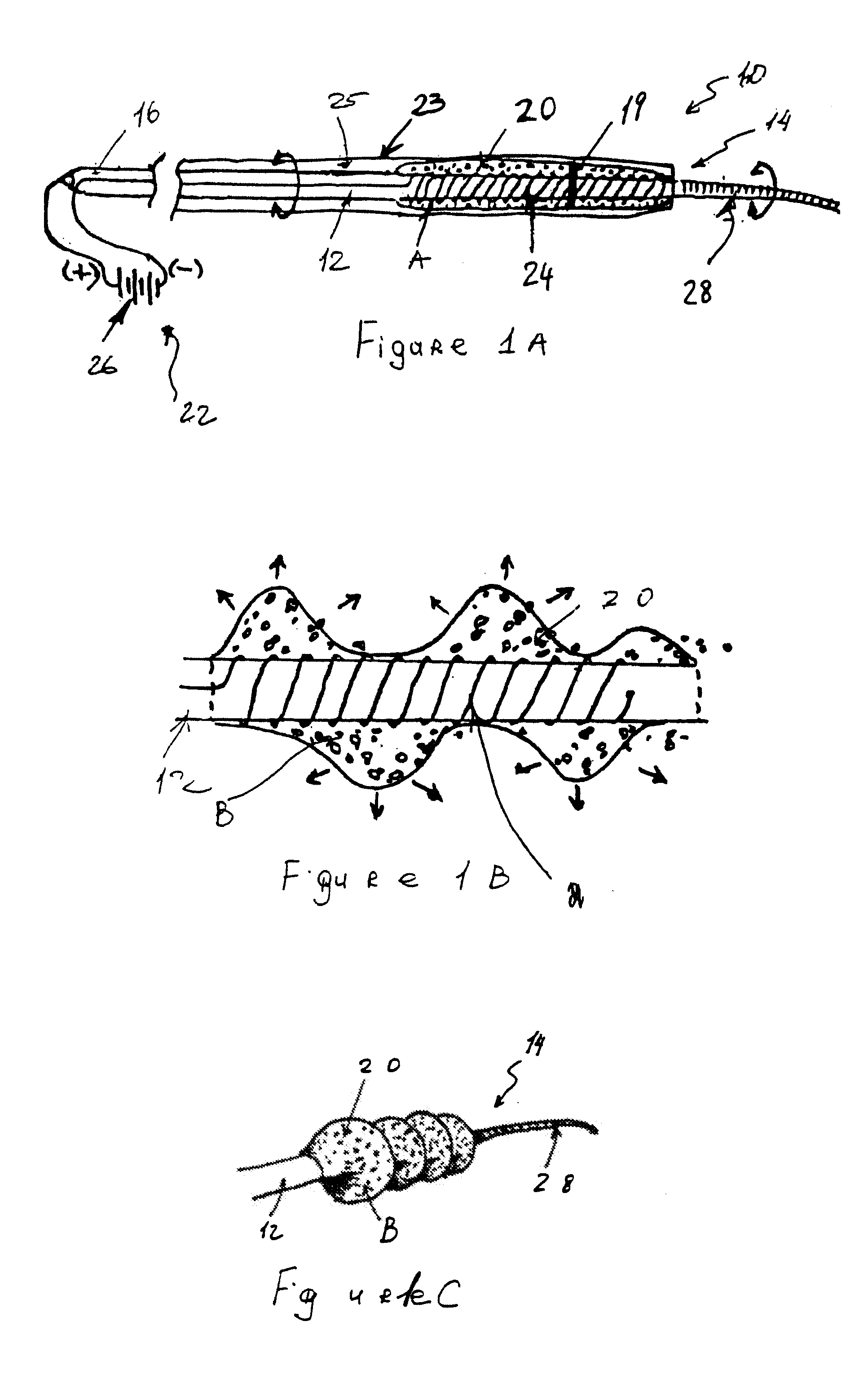 Devices and methods for removing a matter from a body cavity of a patient