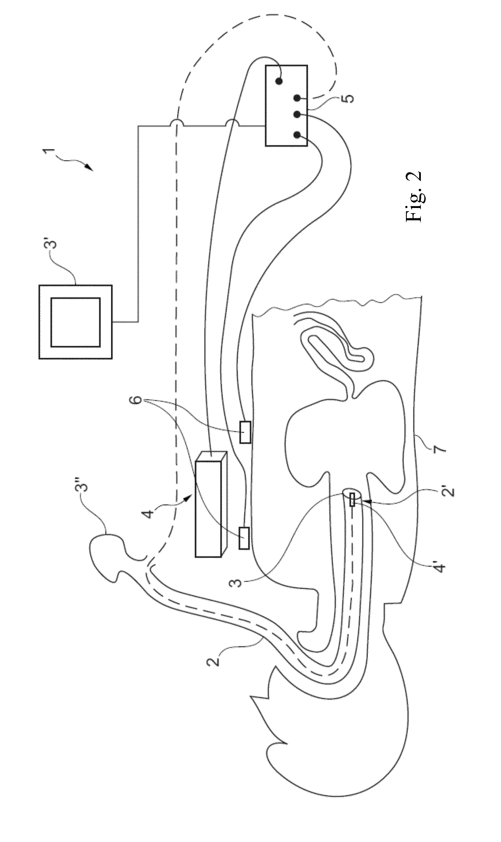 Anatomical site relocalisation using dual data synchronisation