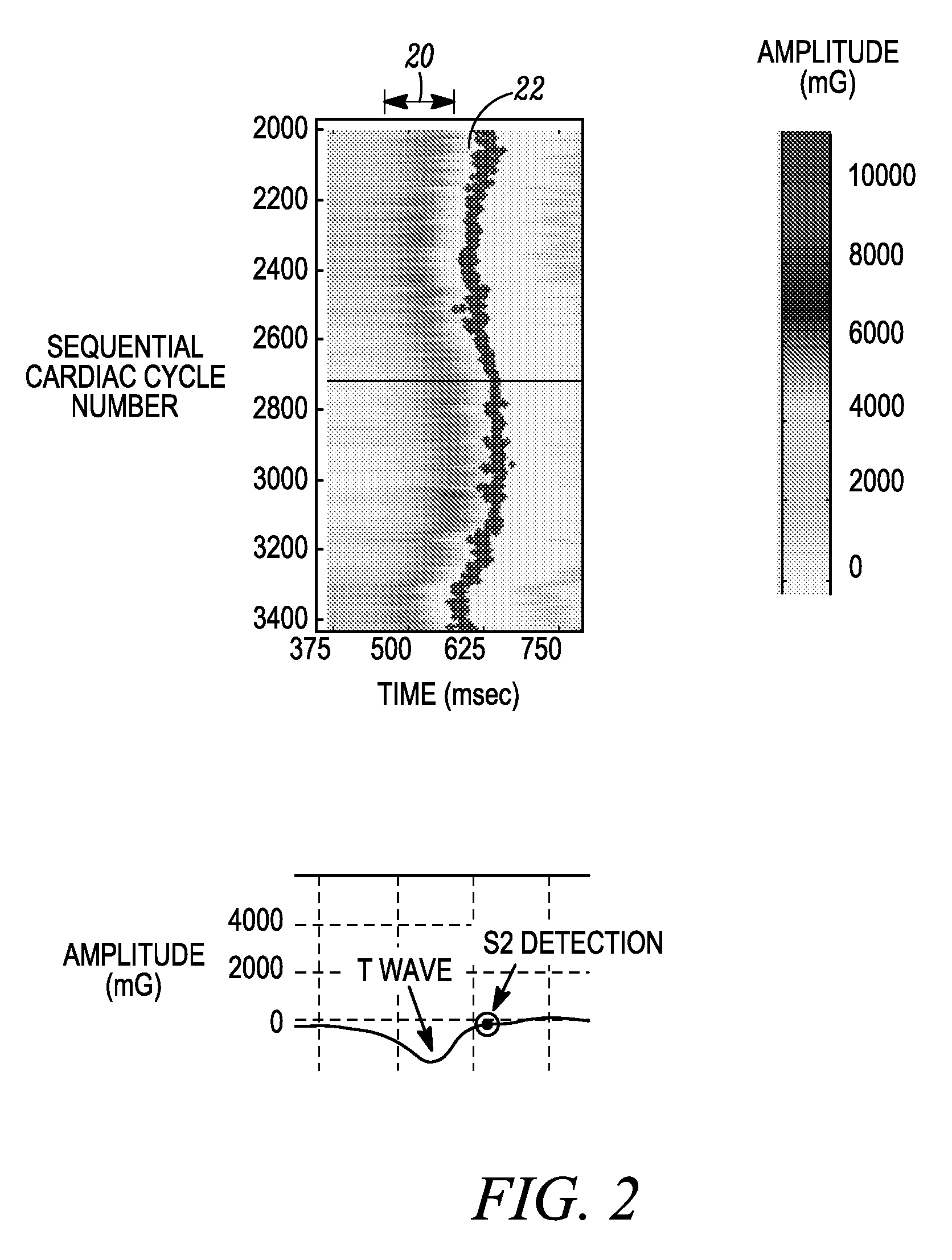 Glycemic control monitoring using implantable medical device