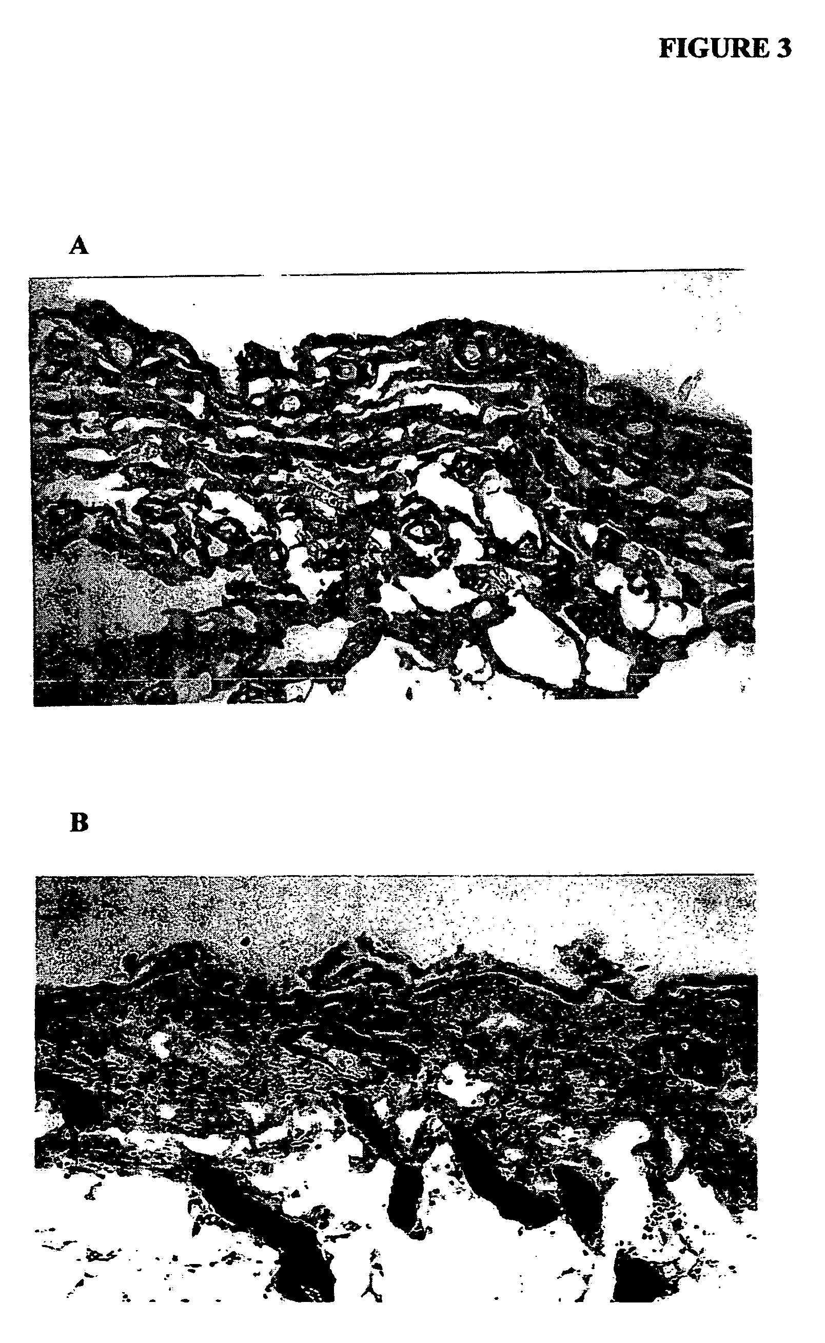 Protein compositions for promoting wound healing and skin regeneration