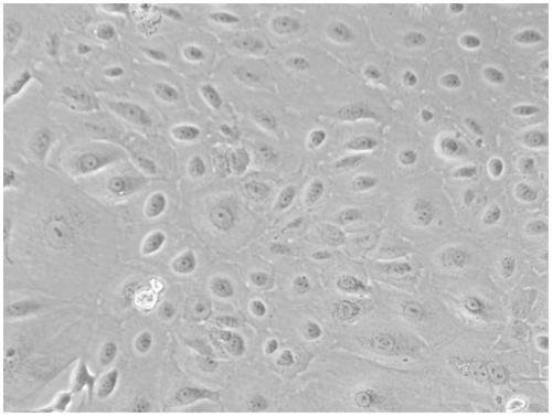 Method for preparing human amniotic membrane epithelial cells from human placental amniotic membrane and application thereof