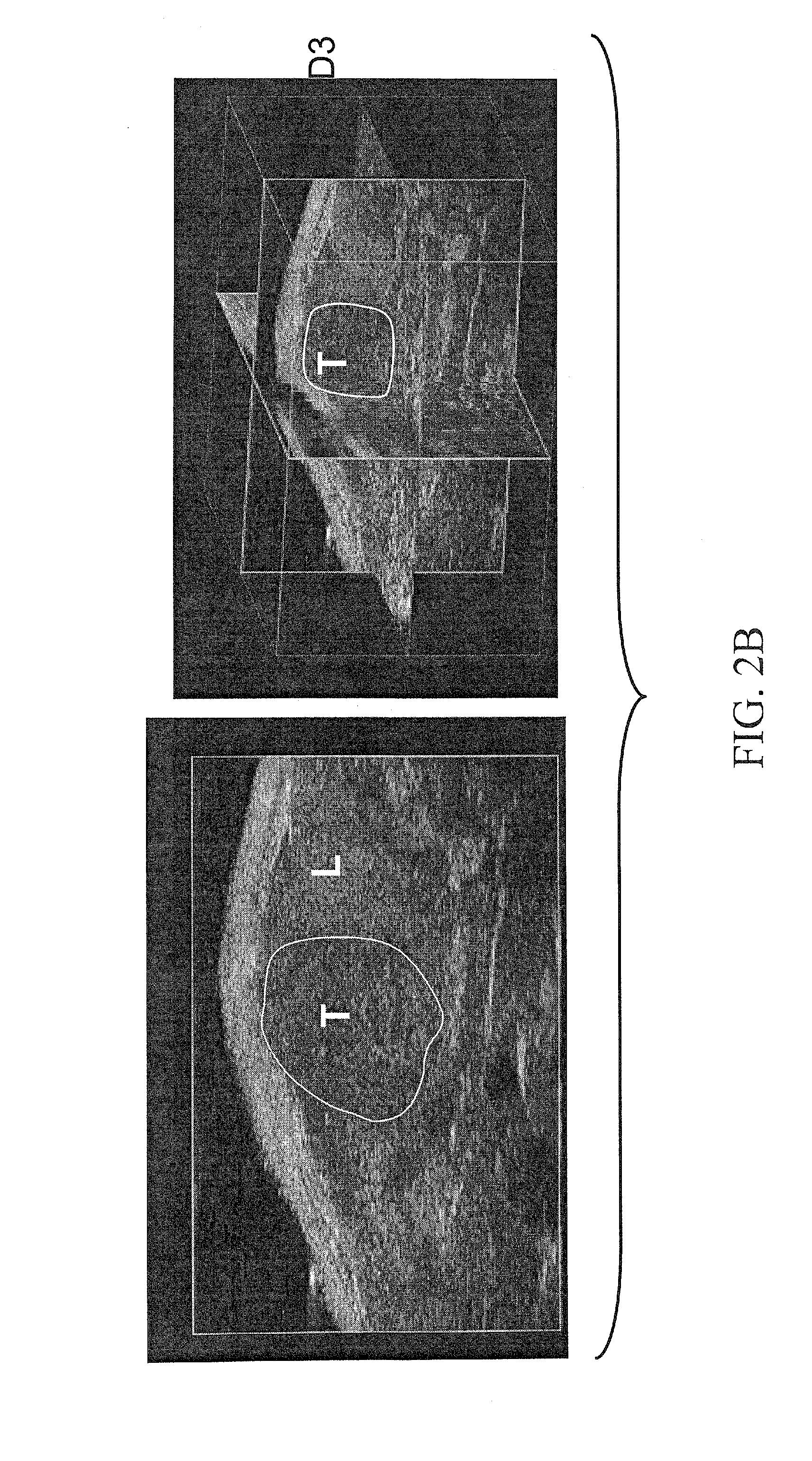 Animal model of human cancer and methods of use