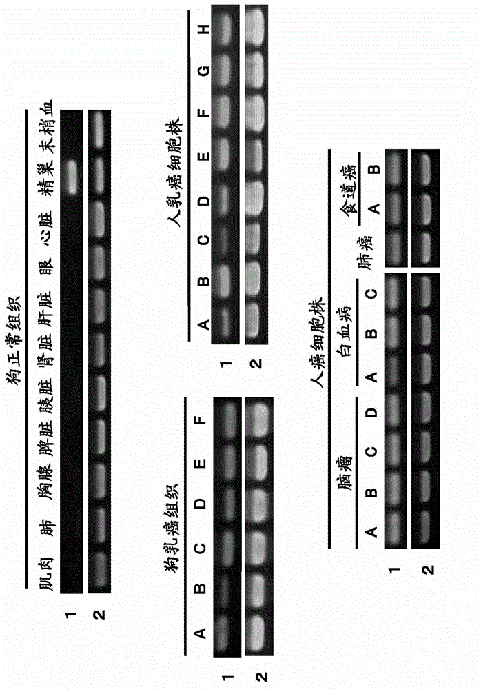 Pharmaceutical composition for treating and/or preventing cancer