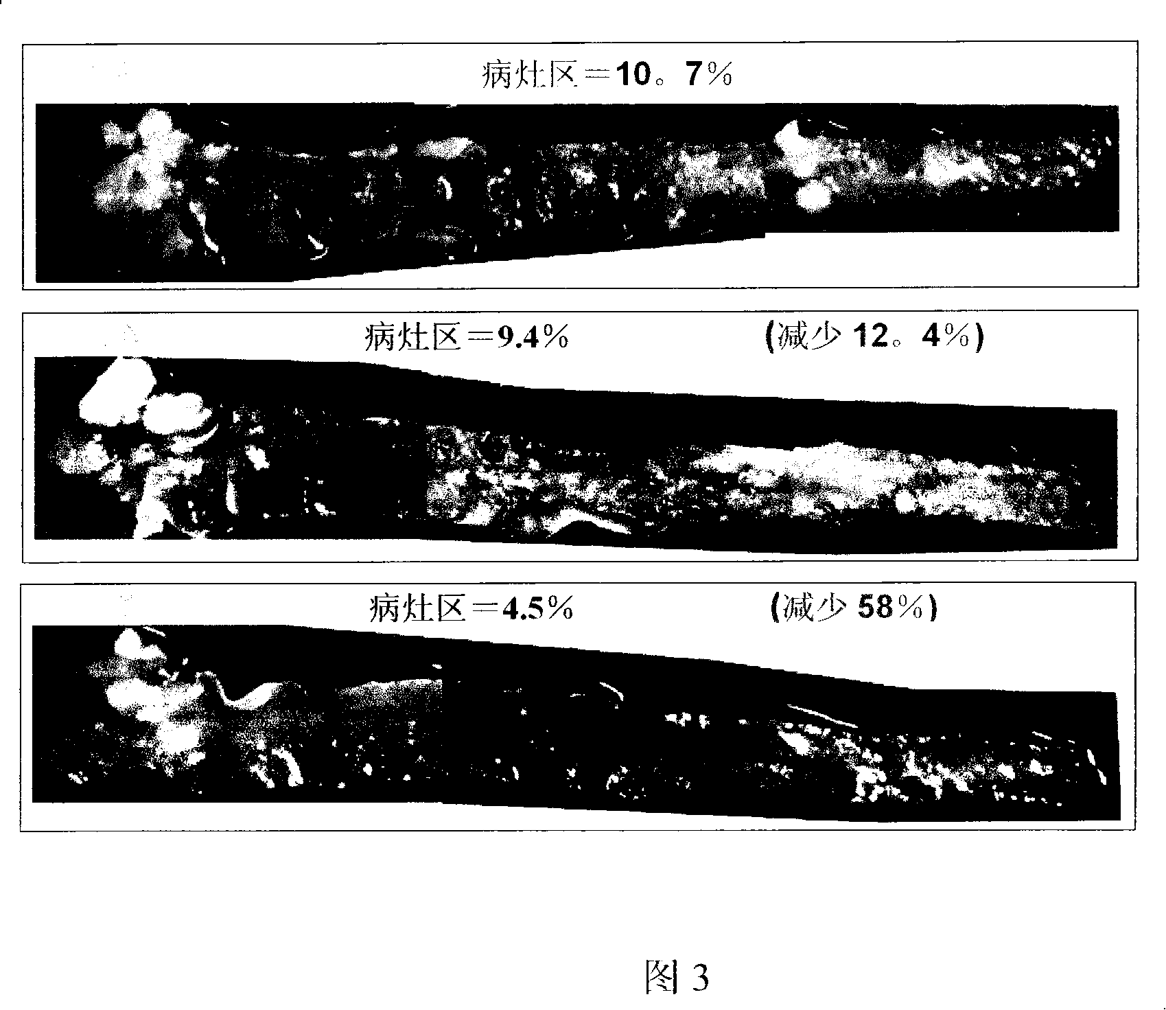 Compounds having lipid lowering properties