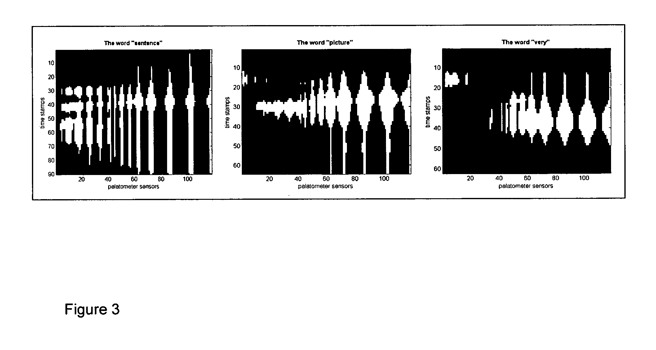 Artificial Larynx