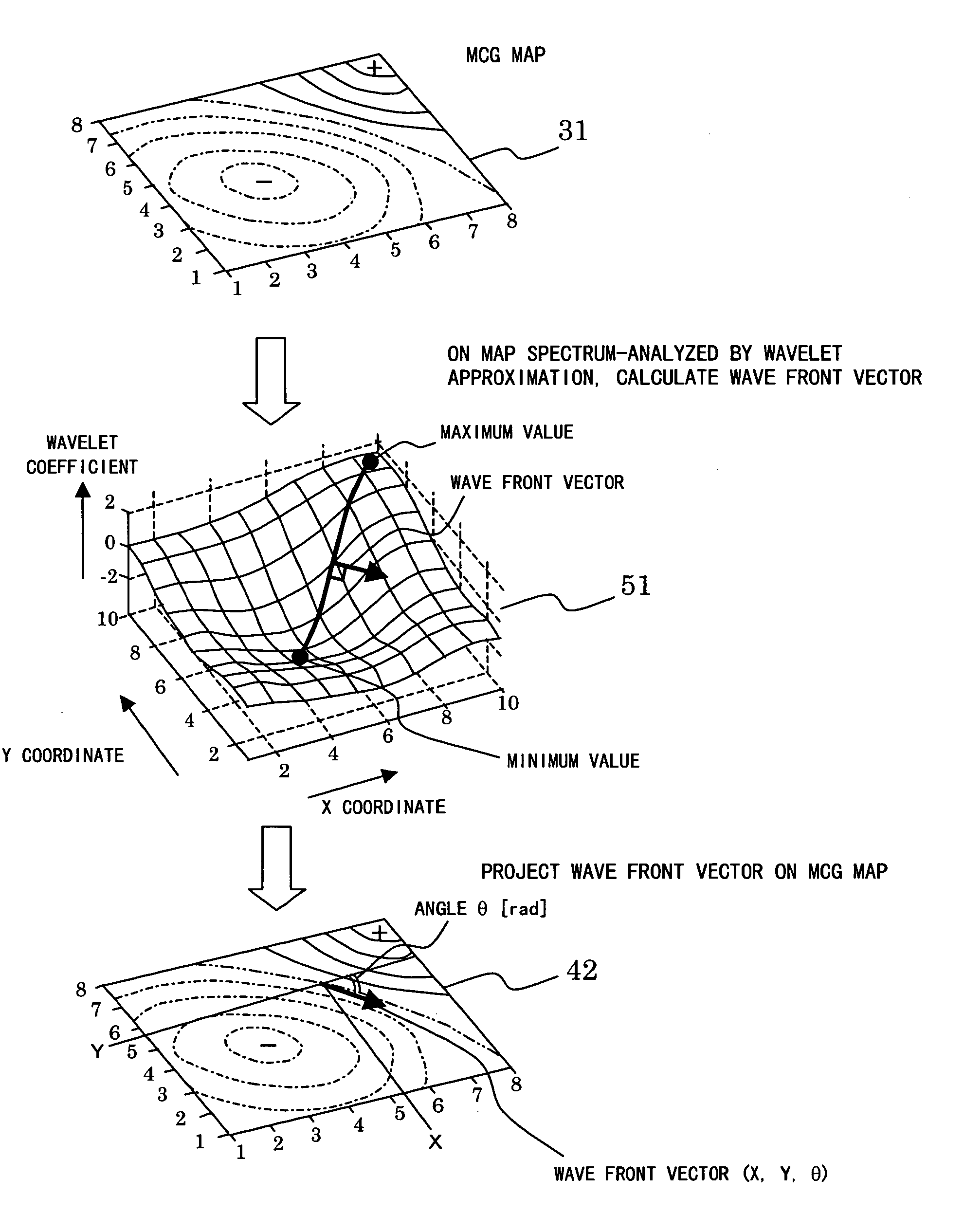 Magnetocardiograph