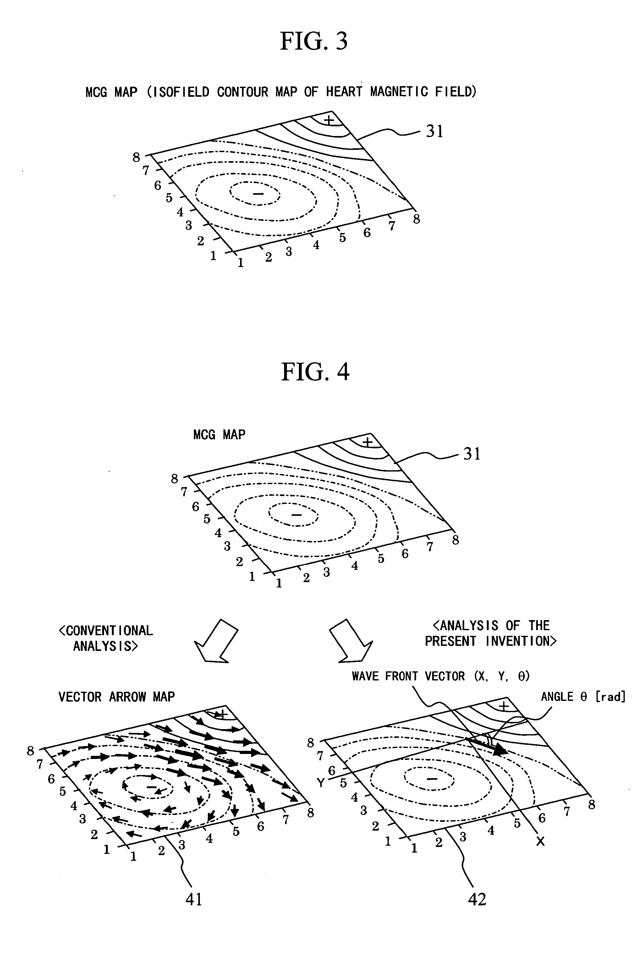 Magnetocardiograph