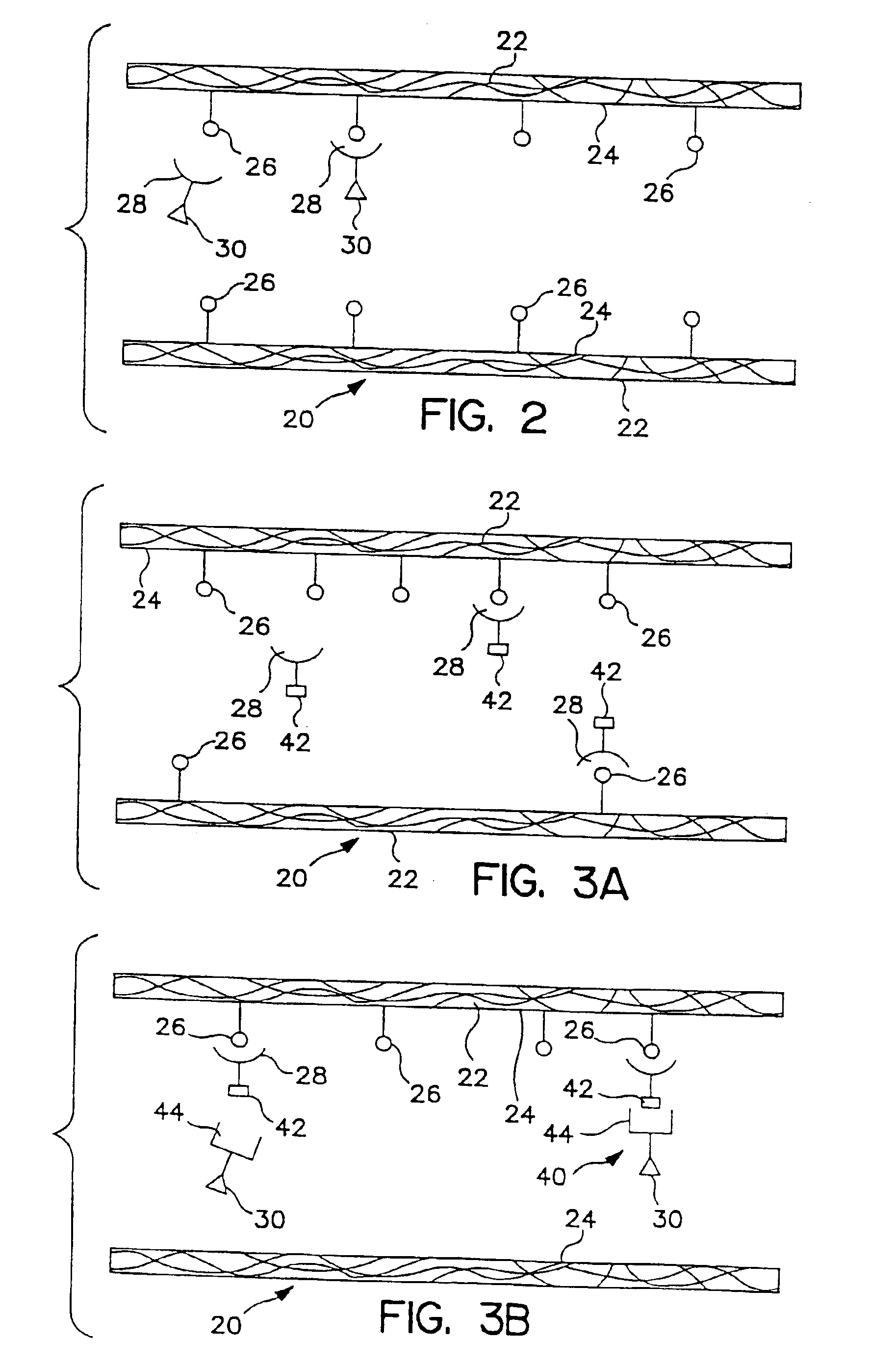 Transcutaneous photodynamic treatment of targeted cells