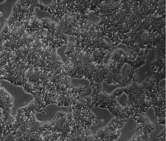 Method for induced differentiation of human embryonic stem cells into NK cells