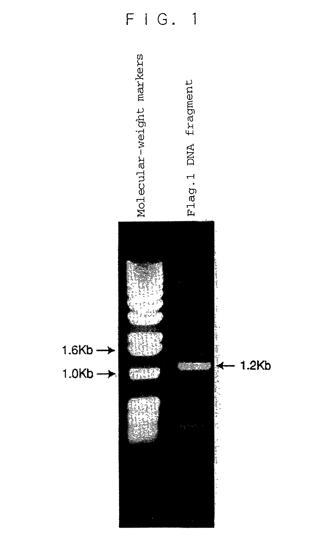 Human ADAMTS-1 protein, gene encoding the same, pharmaceutical composition, and method for immunologically analyzing human ADAMTS-1 protein