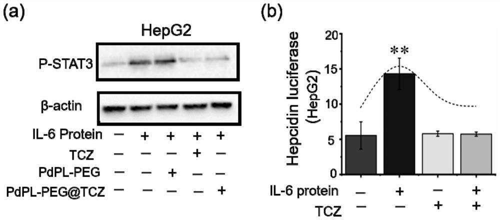 Nano-palladium sheet loaded tuzumab nano-complex, preparation method and application of nano-palladium sheet loaded tuzumab nano-complex in preparation of medicine for treating inflammation-related anemia