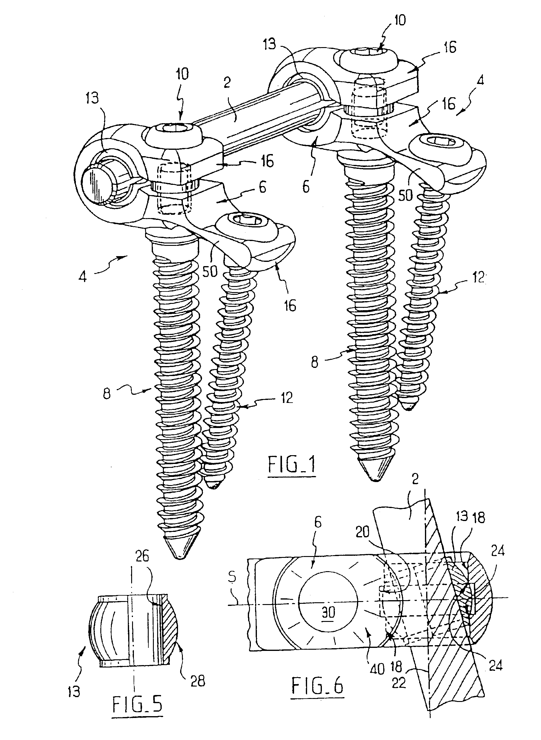 Backbone osteosynthesis system with clamping means in particular for anterior fixing