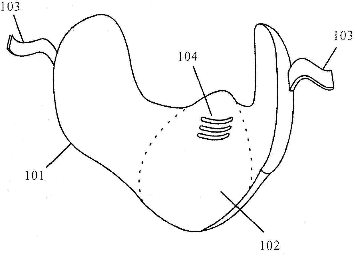 Heat exchange type antibacterial and dustproof mask