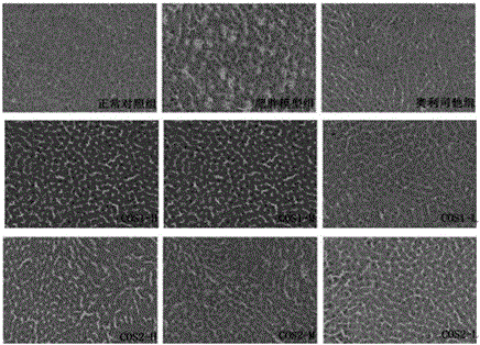 Weight reduction and body fat reduction applications of chitosan oligosaccharide