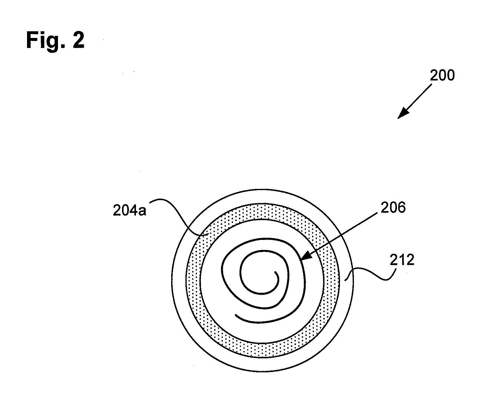 MRI Compatible Leadless Cardiac Pacemaker