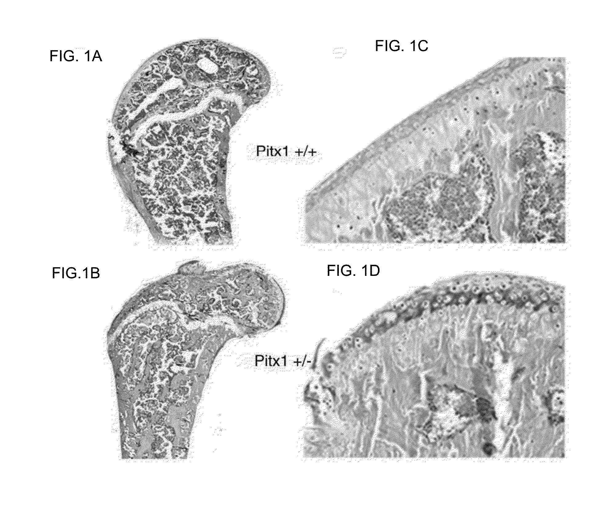 Methods for diagnosing osteoarthritis