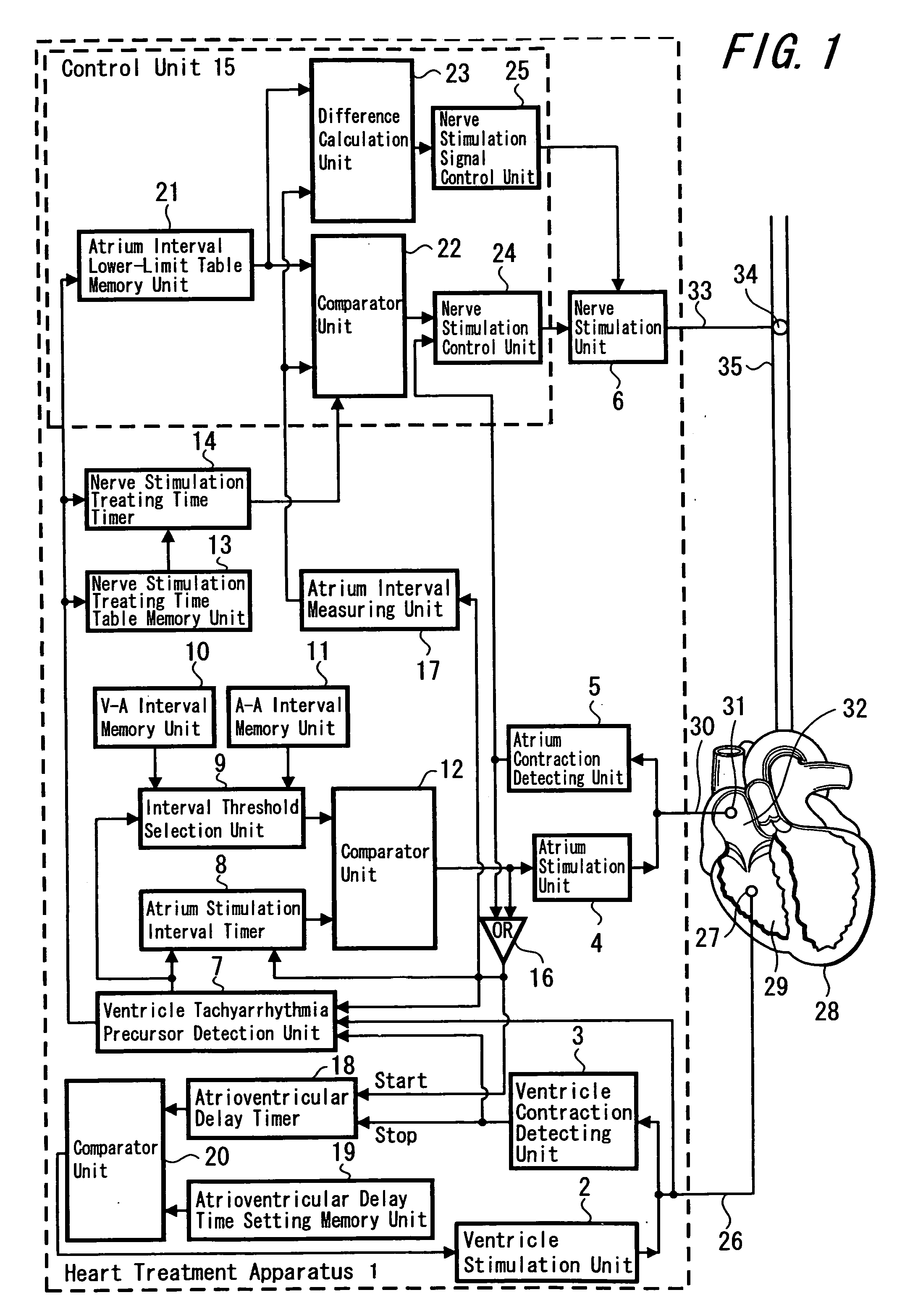 Heart treatment apparatus and heart treatment method