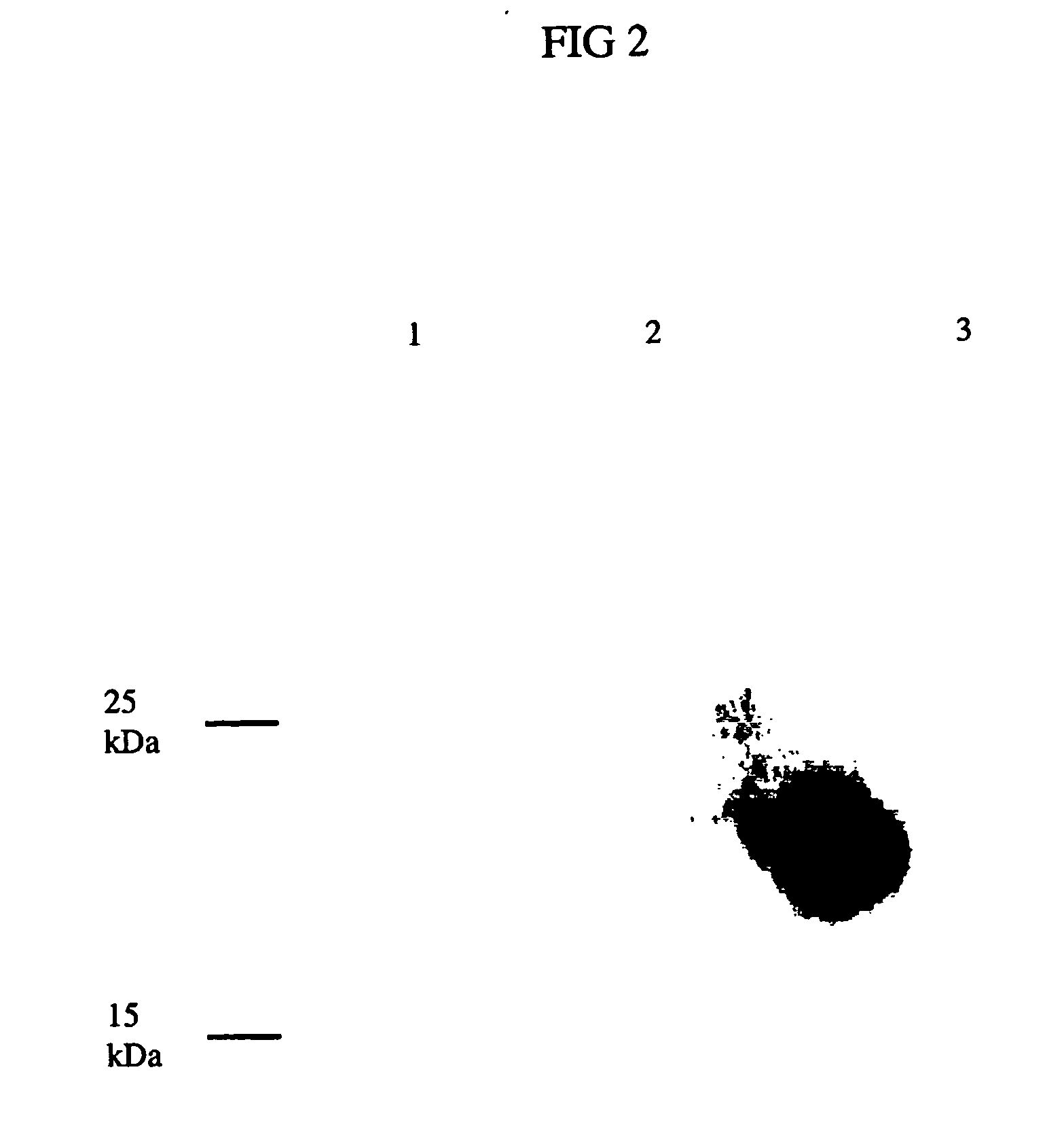 Expression of the human igf-1 in transgenic plastids