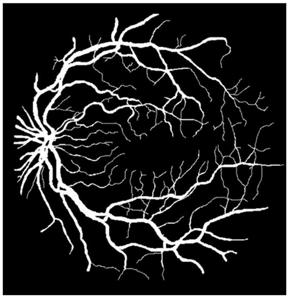 Retinal blood vessel branch angle calculation method and device and electronic equipment